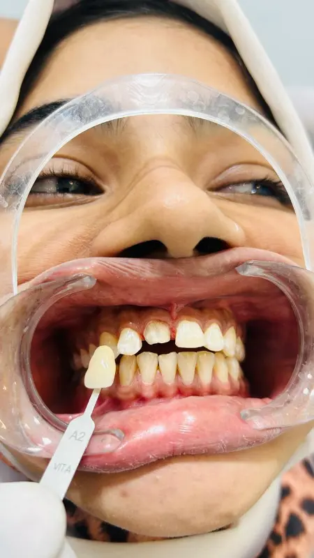 Dental chair and treatment setup